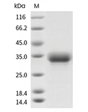 CD32B/Fcgr2b Protein, Human, Recombinant (His & Avi), Biotinylated