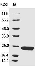 KRAS Protein, Human, Recombinant (G12D, His)