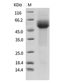 ST2/IL-1 RL1 Protein, Human, Recombinant (His)