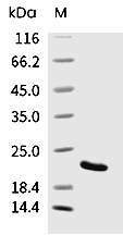 GPX4 Protein, Human, Recombinant (His)