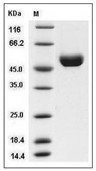 Cathepsin D Protein, Human, Recombinant (His)