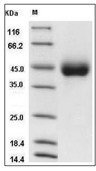 KIR2DL3 Protein, Human, Recombinant (His)