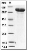 MMP-9 Protein, Human, Recombinant