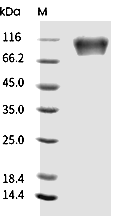 PDGFRA Protein, Human, Recombinant (His)