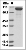 Complement factor B/CFB Protein, Human, Recombinant (His)