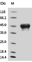 CD25/IL2R alpha Protein, Human, Recombinant (His & Avi), Biotinylated