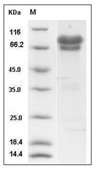 NGFR/p75NTR Protein, Human, Recombinant (hFc)