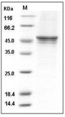 GSK3B Protein, Human, Recombinant (His)