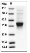 Clusterin Protein, Human, Recombinant (CLU34, His)