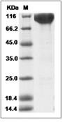 c-Kit Protein, Human, Recombinant (hFc)