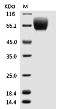 FGFR1 Protein, Human, Recombinant (alpha (IIIb), His)