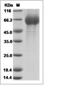 Influenza A H3N2 (A/Texas/50/2012) Hemagglutinin/HA1 Protein (His)