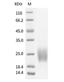 GM-CSF/CSF2 Protein, Human, Recombinant