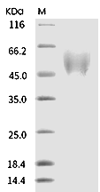 FGFR1 Protein, Human, Recombinant (beta (IIIb), His)