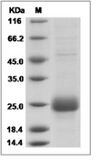 CTLA-4 Protein, Human, Recombinant (His)