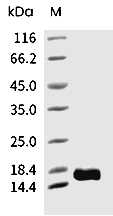 IL-1 beta/IL-1F2 Protein, Rat, Recombinant (mature form)