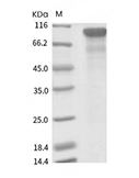 Progranulin Protein, Human, Recombinant (His)