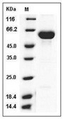 Carboxylesterase 2/CES2 Protein, Human, Recombinant (His)
