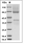 Glypican 3/GPC3 Protein, Human, Recombinant (His)