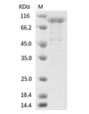 Cadherin 6/CDH6 Protein, Human, Recombinant (His)