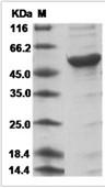 Influenza A H1N1 (A/Brevig Mission/1/1918) Nucleoprotein/NP Protein (His)