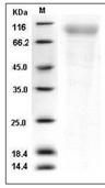 RP105/CD180 Protein, Human, Recombinant (His)