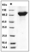 Periostin/OSF-2 Protein, Mouse, Recombinant (His)