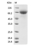 Influenza A H1N1 (A/Puerto Rico/8/1934) Hemagglutinin/HA Protein (HEK293, His)