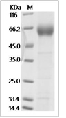 IL-1RAP/IL-1RAcP Protein, Cynomolgus, Recombinant (His)