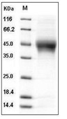 IL-21R Protein, Human, Recombinant (His)