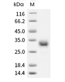 CD40 Protein, Human, Recombinant (His)