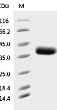 CD25/IL2R alpha Protein, Rat, Recombinant (His)