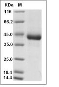 R-Spondin 1/RSPO1 Protein, Human, Recombinant (His)