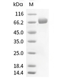 IL-T4 Protein, Human, Recombinant (His)