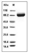 Influenza A H1N1 (A/Solomon Islands/3/2006) Hemagglutinin/HA Protein (His)