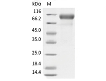 HER2/ERBB2 Protein, Human, Recombinant (aa 1-652, His)