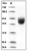 IFNGR1 Protein, Human, Recombinant (His)