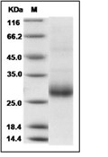 RANKL/TNFSF11/CD254 Protein, Human, Recombinant