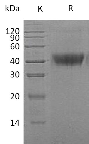 M-CSF/CSF1 Protein, Human, Recombinant (His)