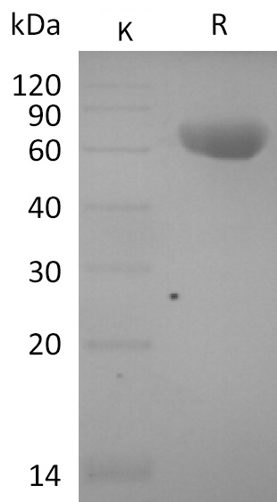 FOLR1 Protein, Human, Recombinant (hFc)