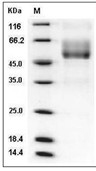 Mucin-1/MUC1 Protein, Human, Recombinant (hFc)