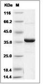 TCPTP Protein, Human, Recombinant
