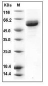 IL-25/IL17E Protein, Human, Recombinant (hFc)