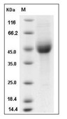 KIR2DL1 Protein, Human, Recombinant (His)