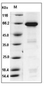 IGFBP-7 Protein, Human, Recombinant (aa 1-282, hFc)
