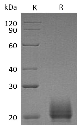 CXCL9 Protein, Mouse, Recombinant (His)