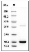 Transthyretin Protein, Human, Recombinant (His)