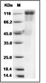 Human cytomegalovirus (HCMV) Glycoprotein B/gB Protein