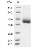 CD122/IL2RB Protein, Rhesus, Recombinant (His)