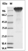 CD45 Protein, Human, Recombinant (aa 26-577, His)